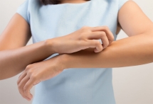 5 astuces naturelles pour faire fuir les moustiques 5 astuces naturelles pour faire fuir les moustiques