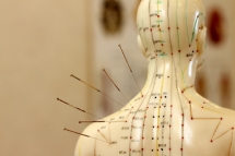 L’acupuncture au secours de la dépression L’acupuncture au secours de la dépression
