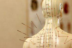 L’acupuncture au secours de la dépression L’acupuncture au secours de la dépression